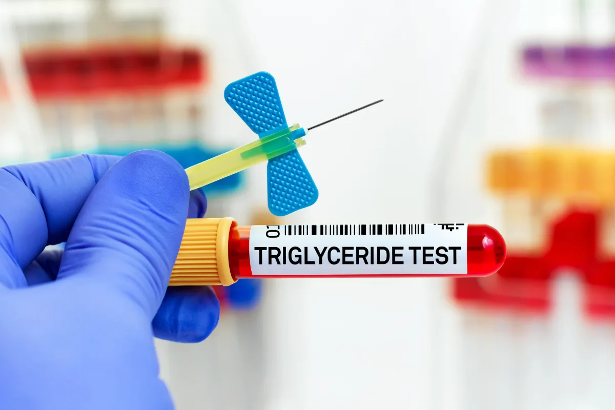 Triglicéridos y diabetes