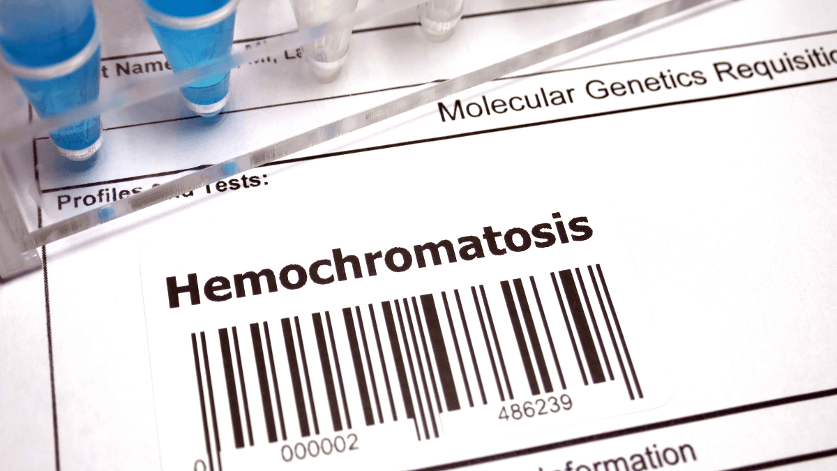 Hemochromatosis