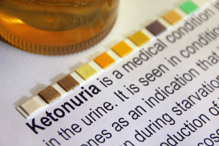 Ketonuria