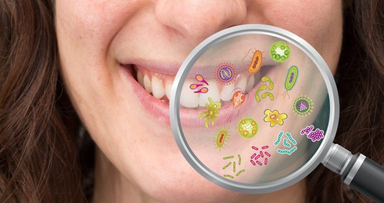 Diabetes and Oral Health: Gum, Tooth, and Treatment Risks