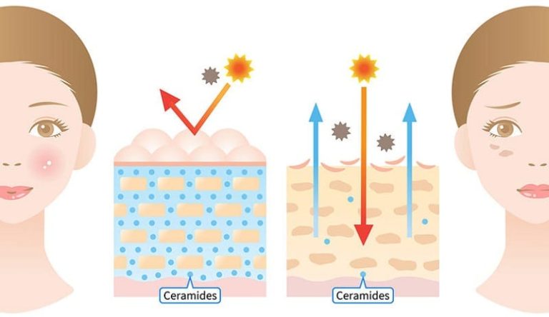 Ceramides and Diabetes: How They Shape Metabolic Risk