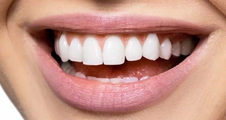Diabetes and Teeth: Gum Risks, Dry Mouth, and Dental Care