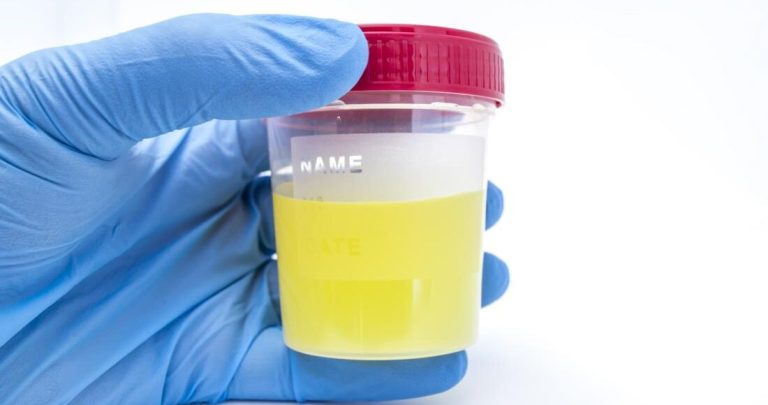 Diabetes Urine Smell: Causes, Warning Signs, and Next Steps