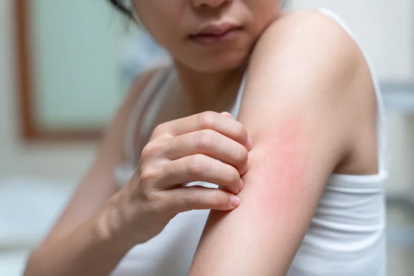 diabetes e infecciones por hongos