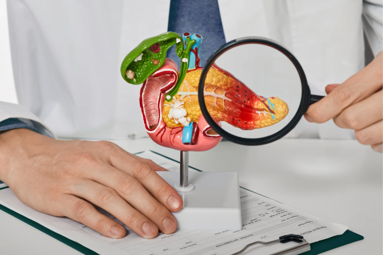 pancreas diabetes