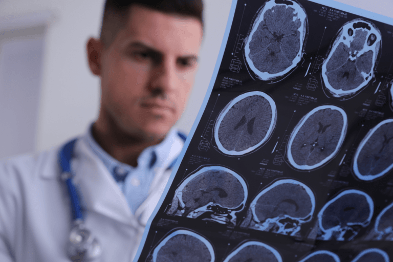 Multiple Sclerosis News: Metformin's Potential